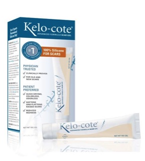 Kelo-cote