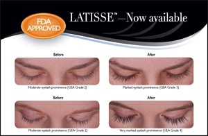 Latisse